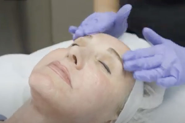 Skin treatment procedure at South Coast MedSpa