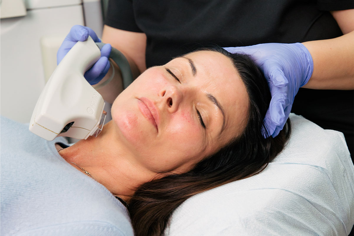 woman during skin rejuvenation in Los Angeles