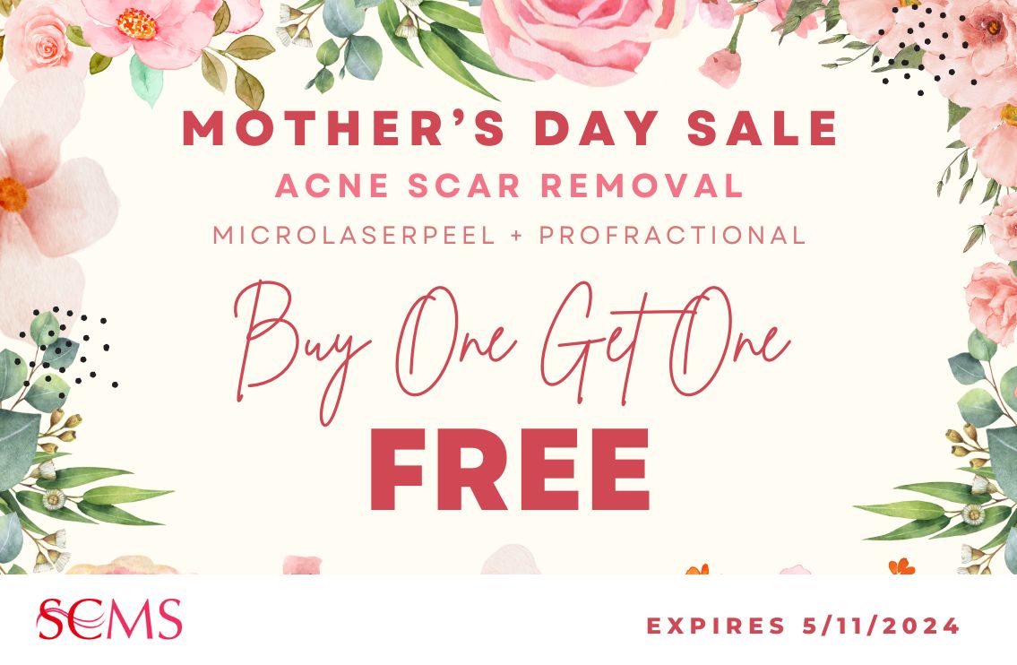 Mother's Day Sale: Buy One Acne Scar Removal Treatment, Get One Free - Expires 5/11/24