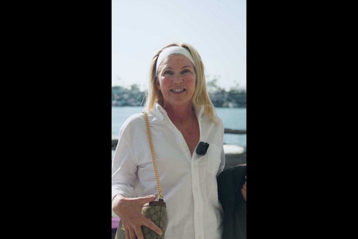Image of patient, Theresa, after her Morpheus8 and BBL Treatments.