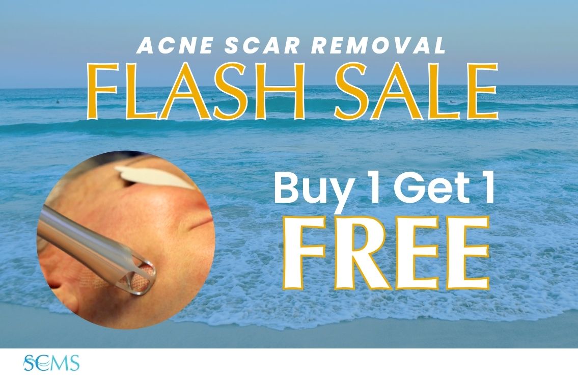 Flash Sale - Buy 1 Acne Scar Removal treatment, get 1 FREE. Limited time offer.