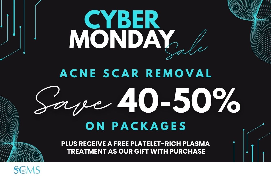 Cyber Monday Sale - Save 40-50% off Acne Scar Removal Packages, plus receive a FREE Platelet-Rich Plasma Treatment as our gift with purchase! Limited Time offer.