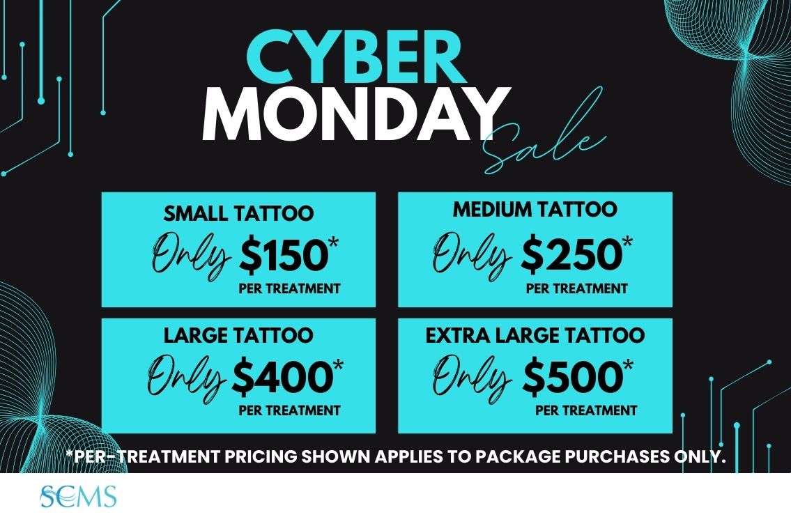 Cyber Monday Sale - Laser Tattoo Removal Small tattoo - Only $150 Per Treatment Medium Tattoo - Only $250 Per Treatment Large Tattoo - Only $400 Per Treatment Extra Large Tattoo - Only $500 Per Treatment. *Per Treatment Pricing shown applies to package purchases only. Limited Time Offer.