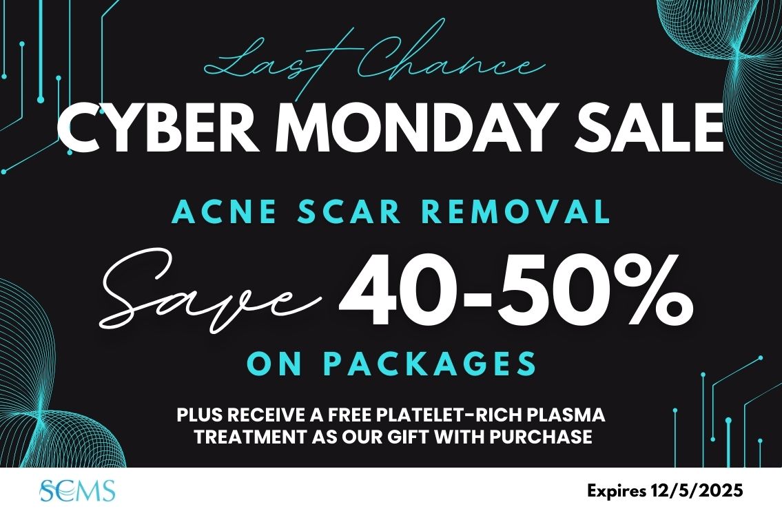 Last Chance Cyber Monday Sale - Save 40-50% off Acne Scar Removal Packages, plus receive a FREE Platelet-Rich Plasma Treatment as our gift with purchase! Expires 12/5/2025