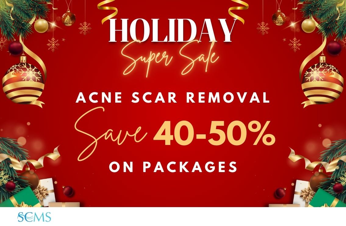 Holiday Super Sale - Save 40-50% off Acne Scar Removal Packages, plus receive a FREE Platelet-Rich Plasma Treatment as our gift with purchase! Limited Time Offer