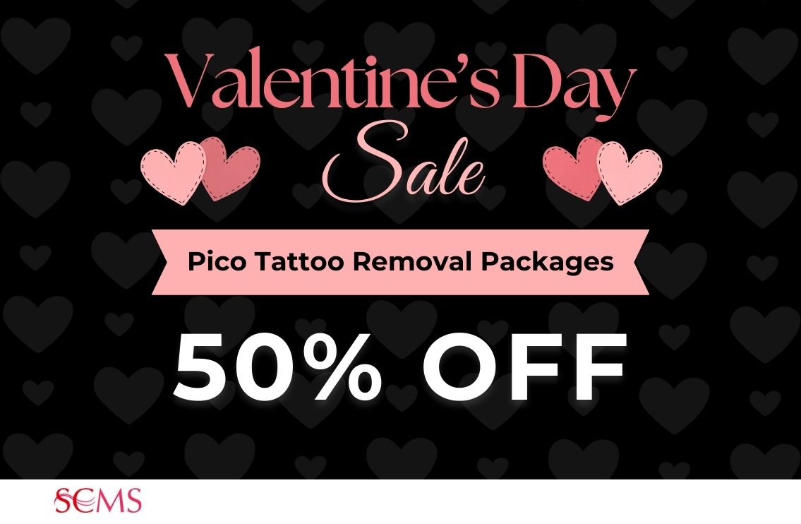 Valentine's Day Sale - Save 50% off Pico Tattoo Removal Packages. Limited Time Offer