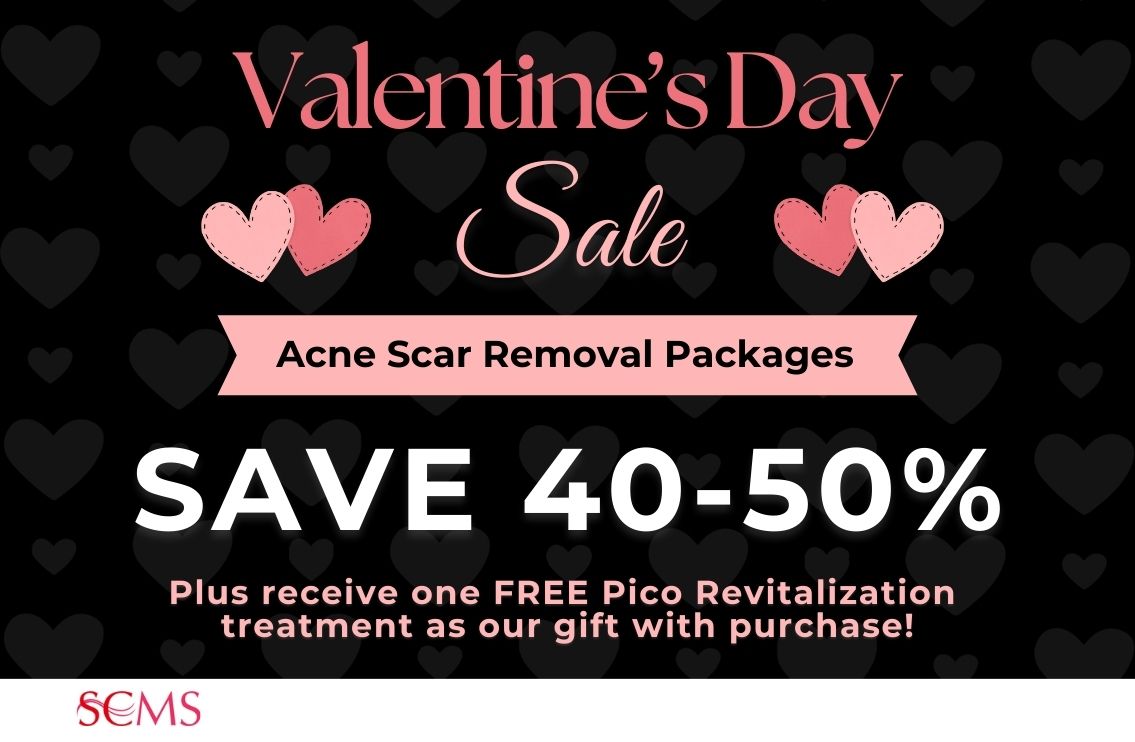 Valentine's Day Sale - Save 40-50% off Acne Scar Removal Paackages, plus receive One Free Pico Revitalization Treatment as our gift with purchase. Limited Time Offer